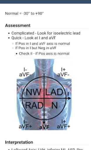 ECG Guide by QxMD 3