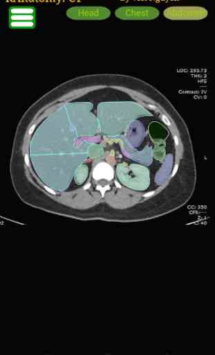 Radiology CT Anatomy 1