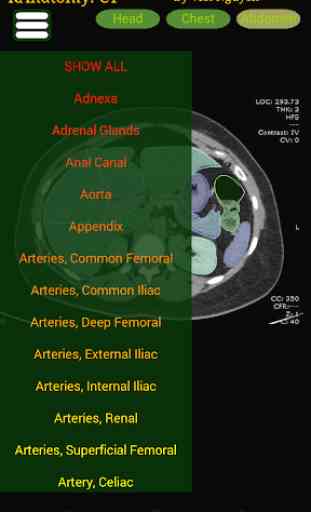 Radiology CT Anatomy 2