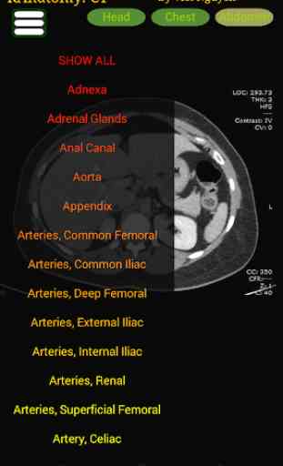 Radiology CT Anatomy 3