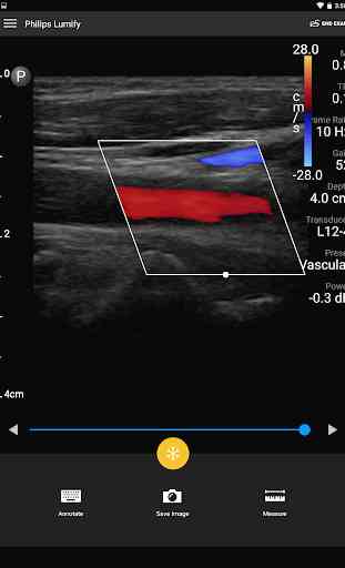 Philips Lumify Ultrasound App 3