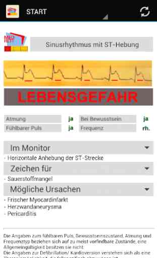 EKG-Monitoring 4