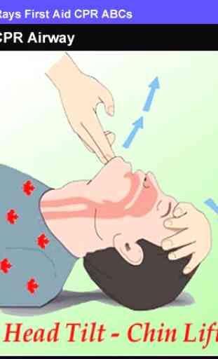 Rays First Aid CPR ABCs 2