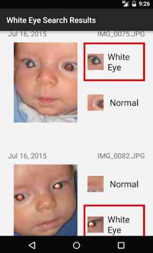 CRADLE White Eye Detector 2