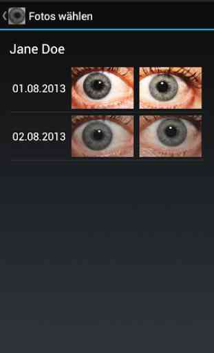 Diagnóstico ocular 1
