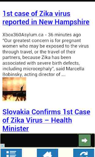 Zika virus and Microcephaly 3