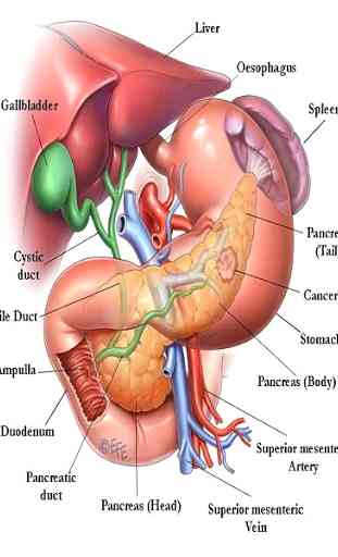 Câncer de pâncreas 2