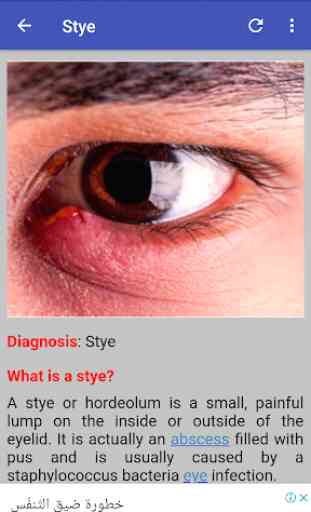 Ophthalmology & Optometry Guide 1