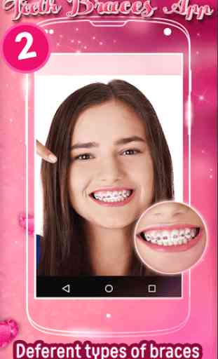 Aparelho Dental App de Montagem 1