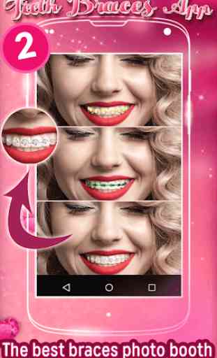 Aparelho Dental App de Montagem 2
