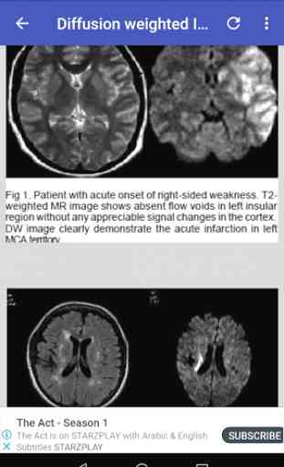 Magnetic Resonance Imaging (MRI) Sequences 3