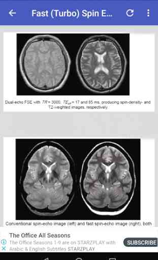 Magnetic Resonance Imaging (MRI) Sequences 4