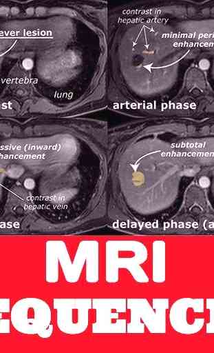 Magnetic Resonance Imaging Sequences - GUIDE 1