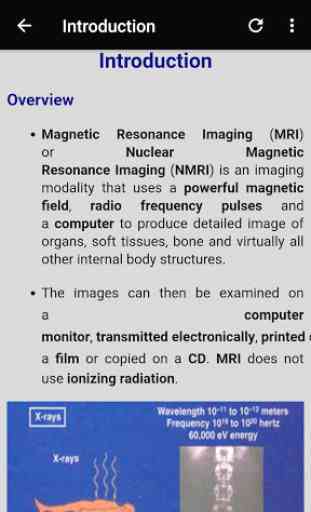 Magnetic Resonance Imaging Sequences - GUIDE 2