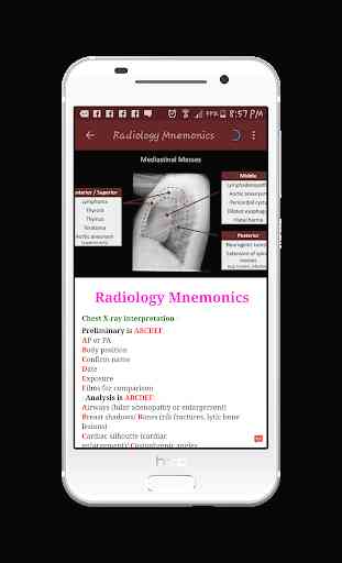 Radiology Mnemonics 1