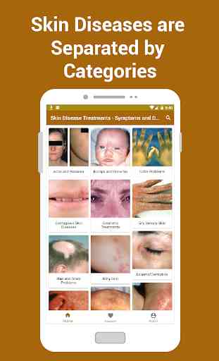 Tratamentos da doença de pele - sintomas 2019 2