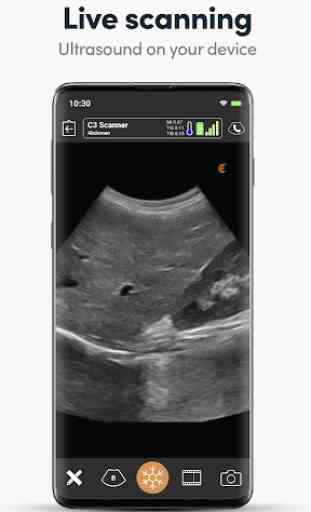 Clarius Ultrasound App 2