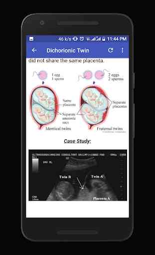 Obstetrics & Gyenacology Ultrasound Guide 2