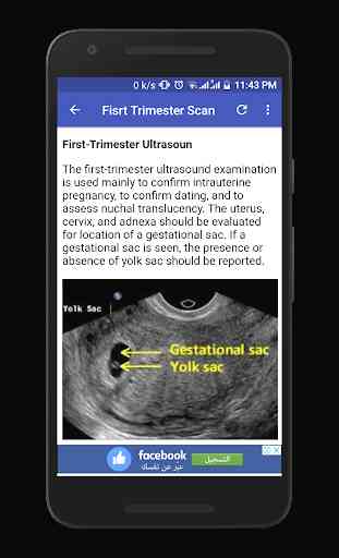 Obstetrics & Gyenacology Ultrasound Guide 3