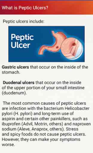 Peptic Ulcers Treatment & Help for Stomach Ulcers 2