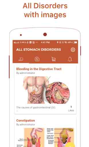Stomach Diseases & Treatment 2