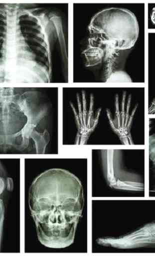 musculoskeletal x-ray interpretation GUIDE 2