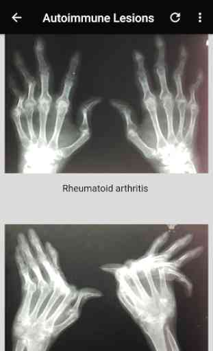 musculoskeletal x-ray interpretation GUIDE 4