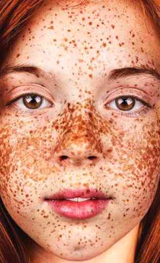 freckles tips 1