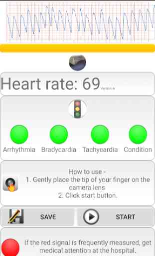 Diagnóstico cardíaco>freqüência cardíaca, arritmia 3