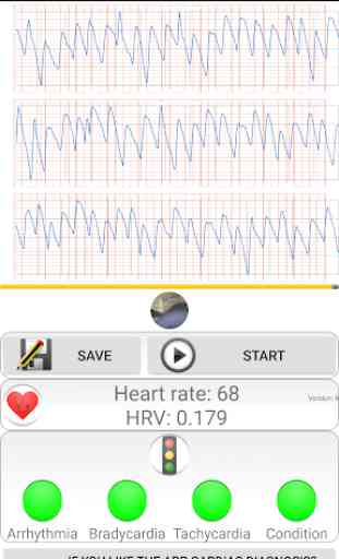Diagnóstico cardíaco>freqüência cardíaca, arritmia 4