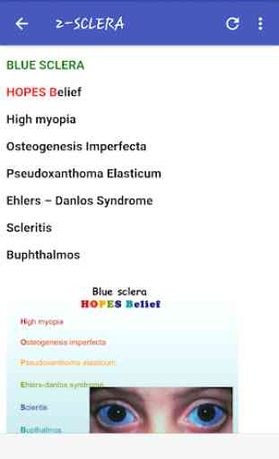Ophthalmology Mnemonics 4