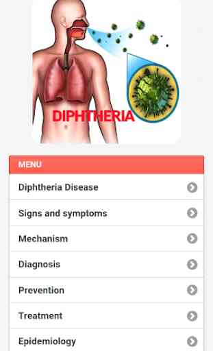 Diphtheria Disease 3