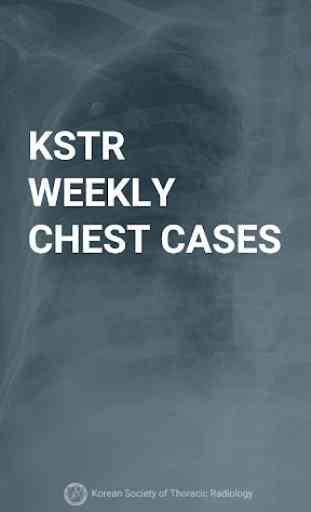KSTR Weekly Chest Cases 1