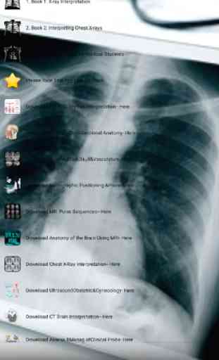 Medical X-Ray Interpretation with 100+ Cases 2