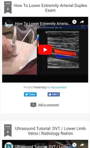 video ultrasound course 4
