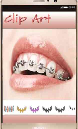 Braces Photo Editor - Braces For Your Teeth 1