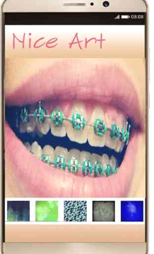 Braces Photo Editor - Braces For Your Teeth 2