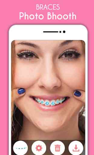 Selfie Braces : Braces Photo Editor & Teeth Booth 1