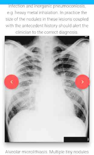 A-Z Chest X-Ray Pathology 3