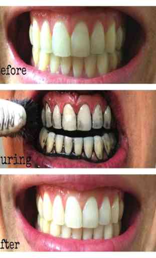 Recipes for teeth whitening 1