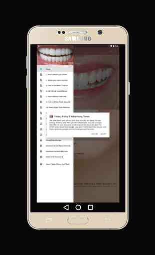 Teeth Whitening Tips: How to Remove Teeth Stains 1
