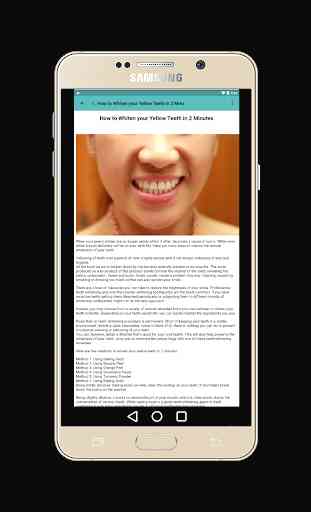 Teeth Whitening Tips: How to Remove Teeth Stains 4