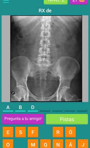 Quiz Radiografias 4