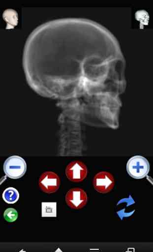 X-ray 3D images -head volume- 2