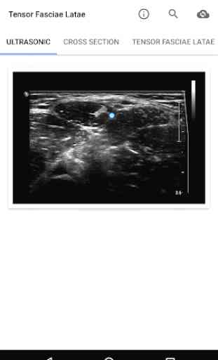 Muscle Ultrasound Course 4