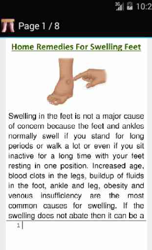 Swelling Feet Home Remedies 2