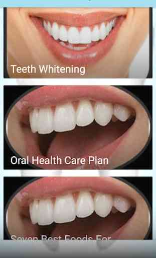 Teeth whitening 2