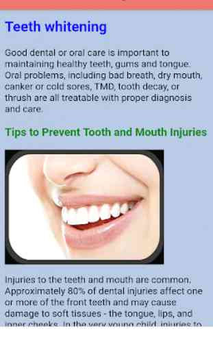 Teeth whitening 3