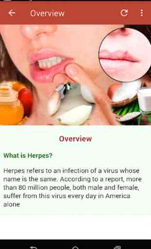 Herpes Solution 2