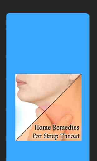 Home Remedies For Strep Throat 1